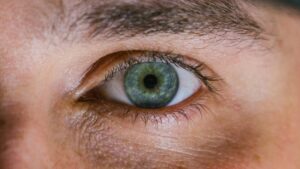 Cataract cause and symptom