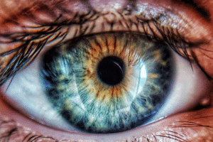 Understanding coats disease 2